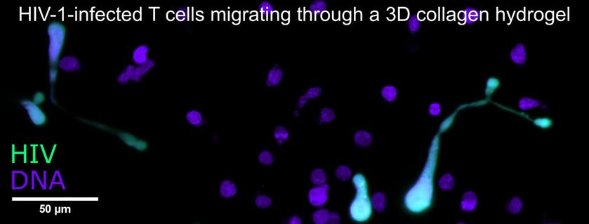 HIV-1-infected T cells migrating through a 3D collagen hydrogel HIV-1-infected T cells migrating through a 3D collagen hydrogel