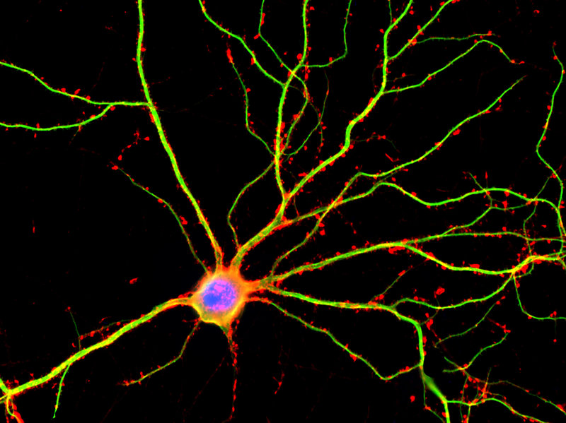 A neuron A neuron