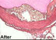 Mouse aorta post microdissection