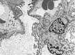 TEM image of kidney tubule