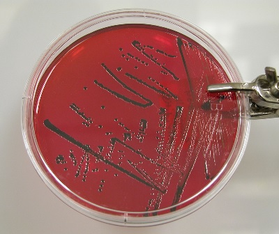 Salmonella in Petri Dish
